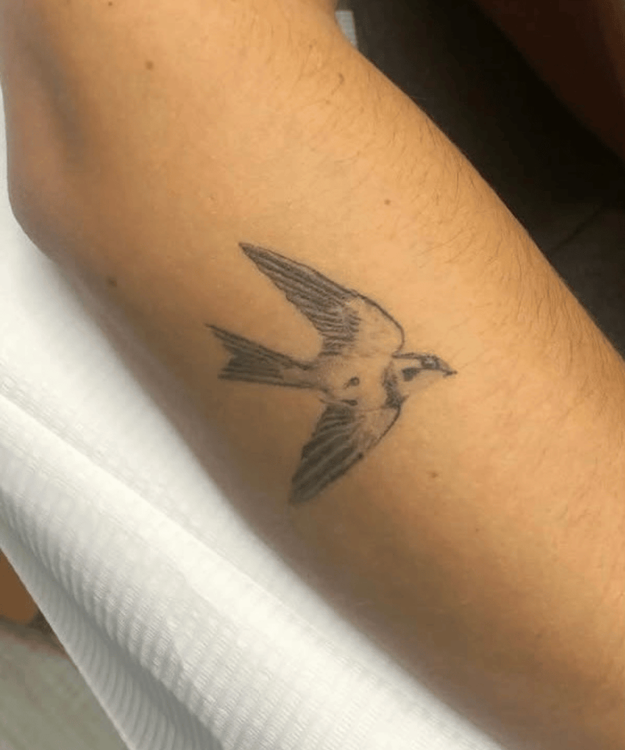 Voor en na resultaat van tattoo verwijderen met laser